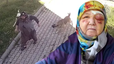 Köpeklerden kaçarken düşen yaşlı kadın yaralandı: O anlar kamerada