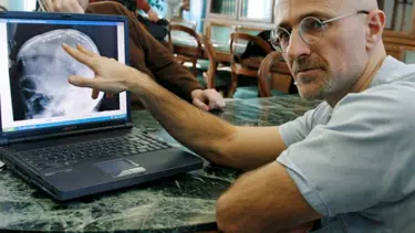 Kafa nakli için tarih verdi