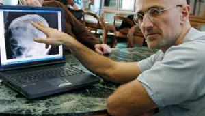 Kafa nakli için tarih verdi Kafa nakli için tarih verdi