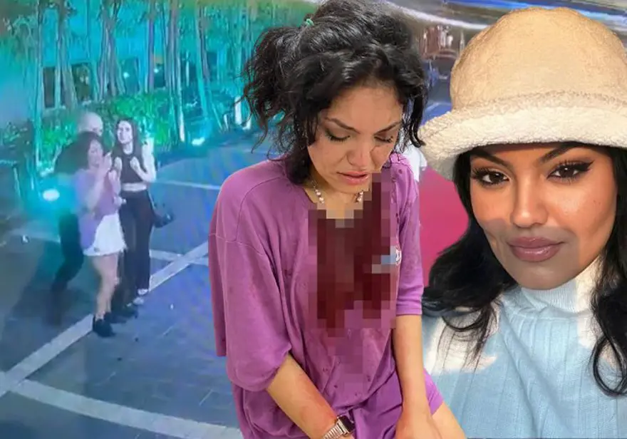 Kısmetse Olur yarışmacısı Eslem Sena Nur yaşadığı saldırıyı anlattı! "2 kız beni yatırıp patakladı, kafama çakı soktular" Kısmetse Olur yarışmacısı Eslem Sena Nur yaşadığı saldırıyı anlattı! "2 kız beni yatırıp patakladı, kafama çakı soktular"