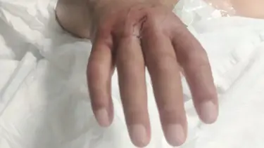 Narenciye toplayan çiftçiyi yılan soktu