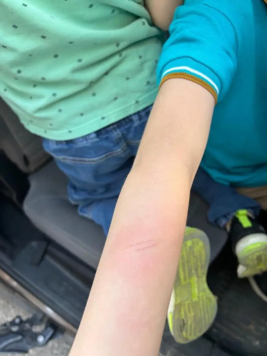 ANNESİ OKULA ÇAĞRILDI 2