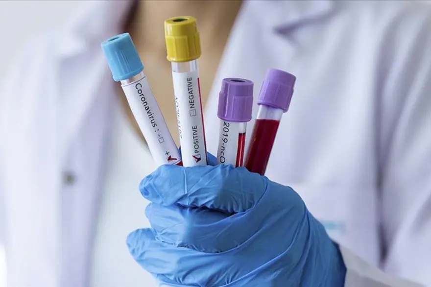 Covid-19 laboratuvarda mı üretildi? ABD istihbaratı ikiye bölündü 3 Covid-19 laboratuvarda mı üretildi? ABD istihbaratı ikiye bölündü 3