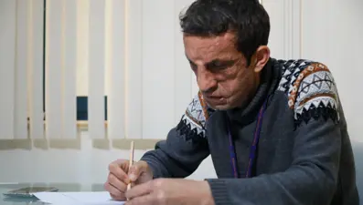 Türkiye'de yüz nakli olan ilk hasta üniversite hayali için çalışıyor