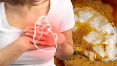 2 kalp profesörü "sofranızdan acil kaldırın" diyerek uyarıyor: 1 lokması bile kalp krizinin 1 numaralı nedeni