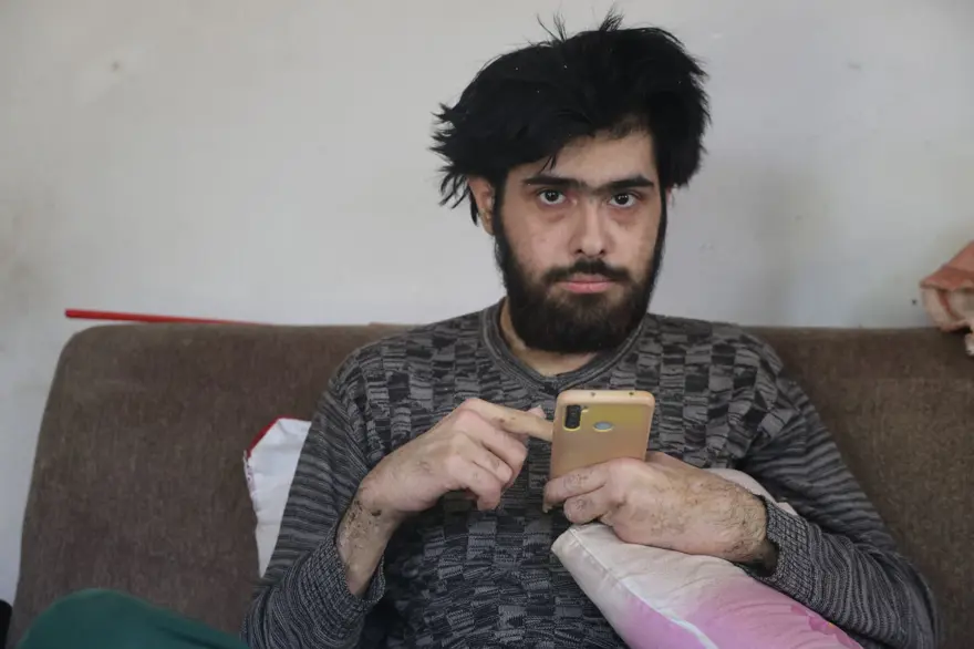 3 yıldır evden dışarı adım atmadı: "Banyo da yapmak istemiyorum, elimde olsa tuvalete gitmem" 3 yıldır evden dışarı adım atmadı: "Banyo da yapmak istemiyorum, elimde olsa tuvalete gitmem"