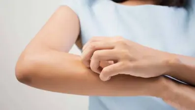 Kaşıntı kanser habercisi olabilir!