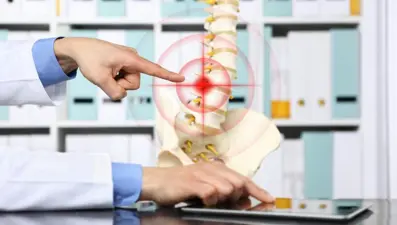 Bel fıtığı tedavisinde girişimsel işlem avantajı (Epiduroskopi nedir?)