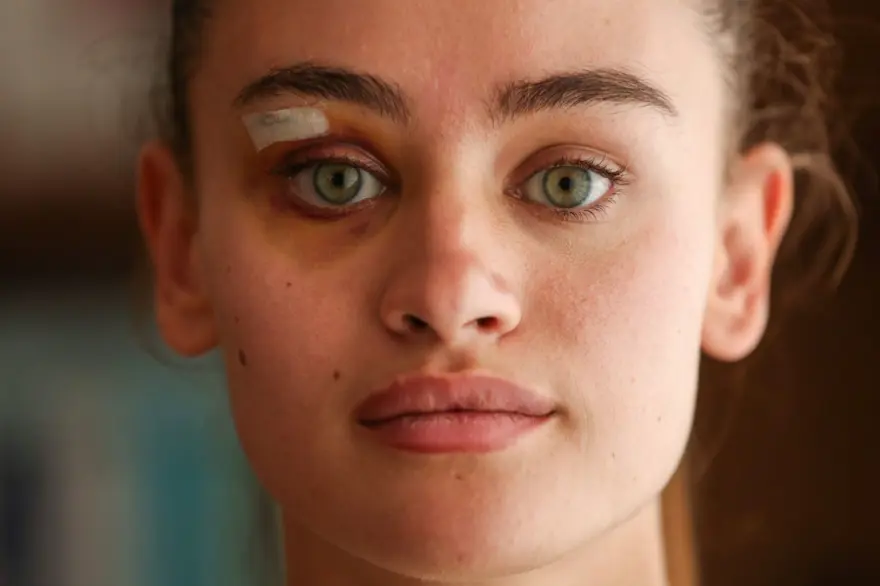 Ukraynalı model darp iddiasıyla ilgili konuştu Ukraynalı model darp iddiasıyla ilgili konuştu