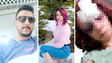 Erkek arkadaşı öldüresiye dövdü: 4 gündür yoğun bakımda