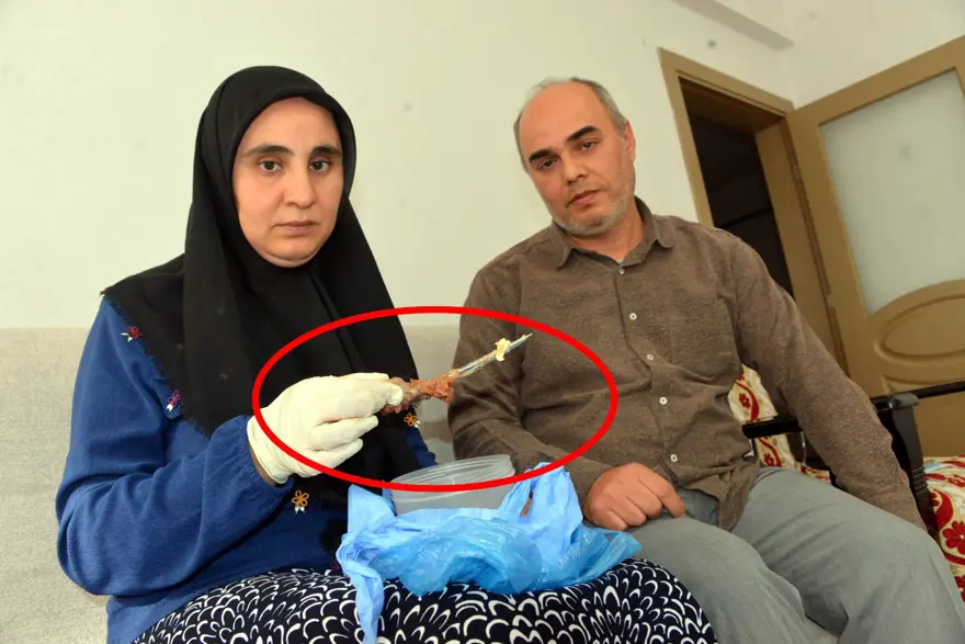 Karnında makas unutuldu,  7 yıl sonra böyle ortaya çıktı: "Mucize eseri hayatta kalmışım" 