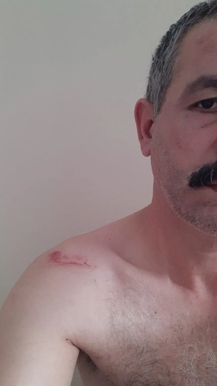 "Niye çöp atıyorsun?" deyince15 kişi saldırdı 3