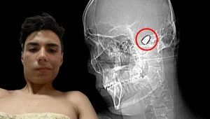 Kafasının içinde patlamaya hazır bomba ile dolaşıyor Kafasının içinde patlamaya hazır bomba ile dolaşıyor