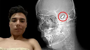 Kafasının içinde patlamaya hazır bomba ile dolaşıyor