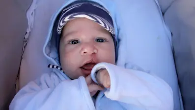 "Dudak ve damak yarıklarının tedavisinde Türkiye önemli bir yerde"