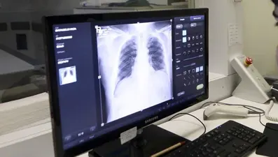 KOAH hangi belirtilerle ortaya çıkar, nasıl tedavi edilir?