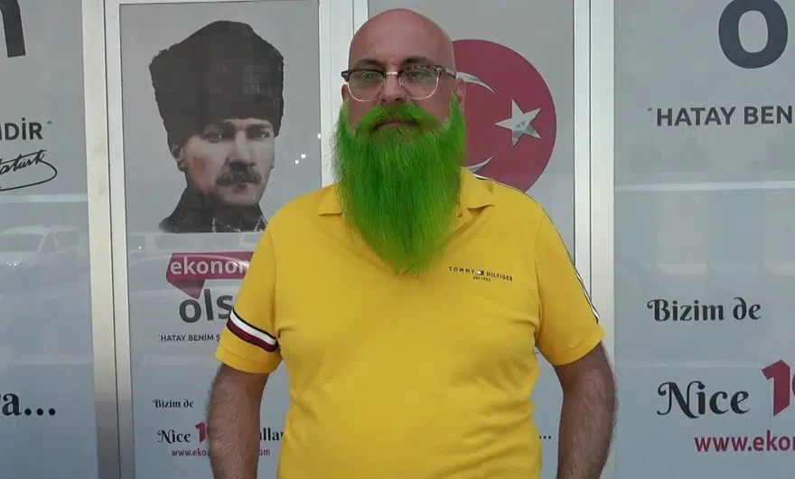 Sakalları gören herkesin dikkatini çekiyor! Rengi ruh haline göre değişiyor 2