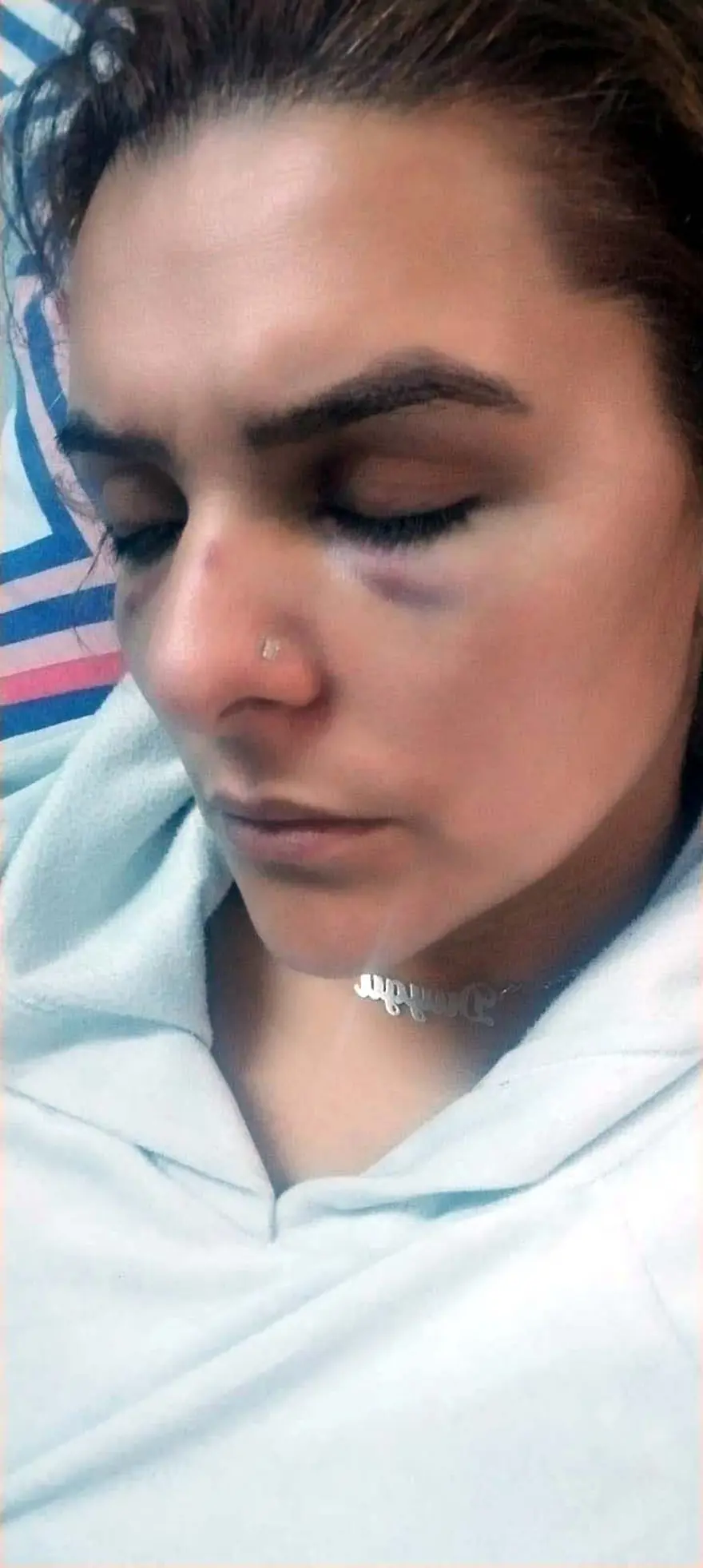 Roman ailelerin fahri koordinatörüne saldırı 1