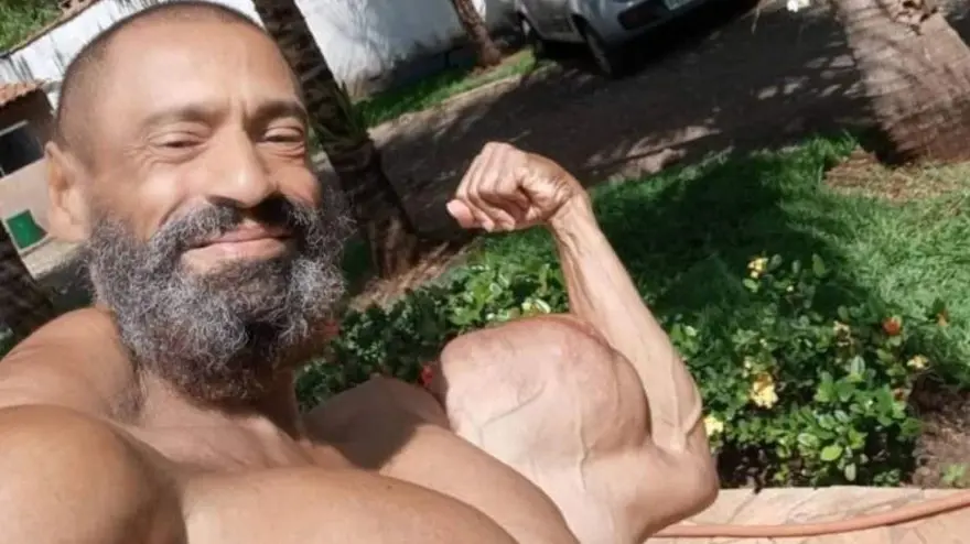 SYNTHOL NEDİR? 7