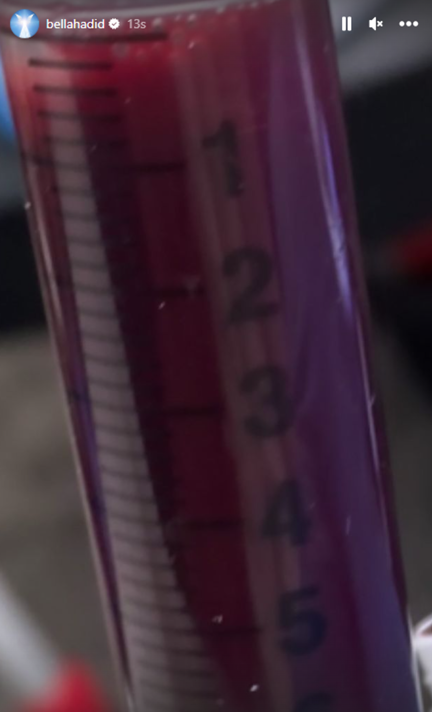 Bella Hadid hastane paylaşımıyla endişe uyandırdı 3