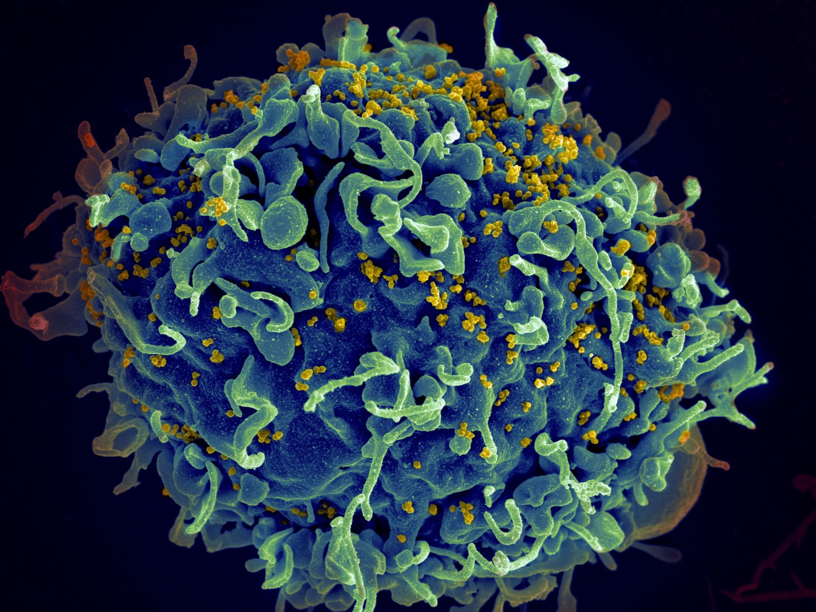HIV tedavisinde çığır açacak adım: mRNA temelli yöntem umut verdi