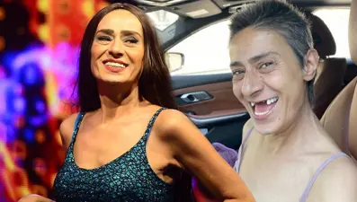 İmplant tedavisi gören Yıldız Tilbe'den dişsiz fotoğraf