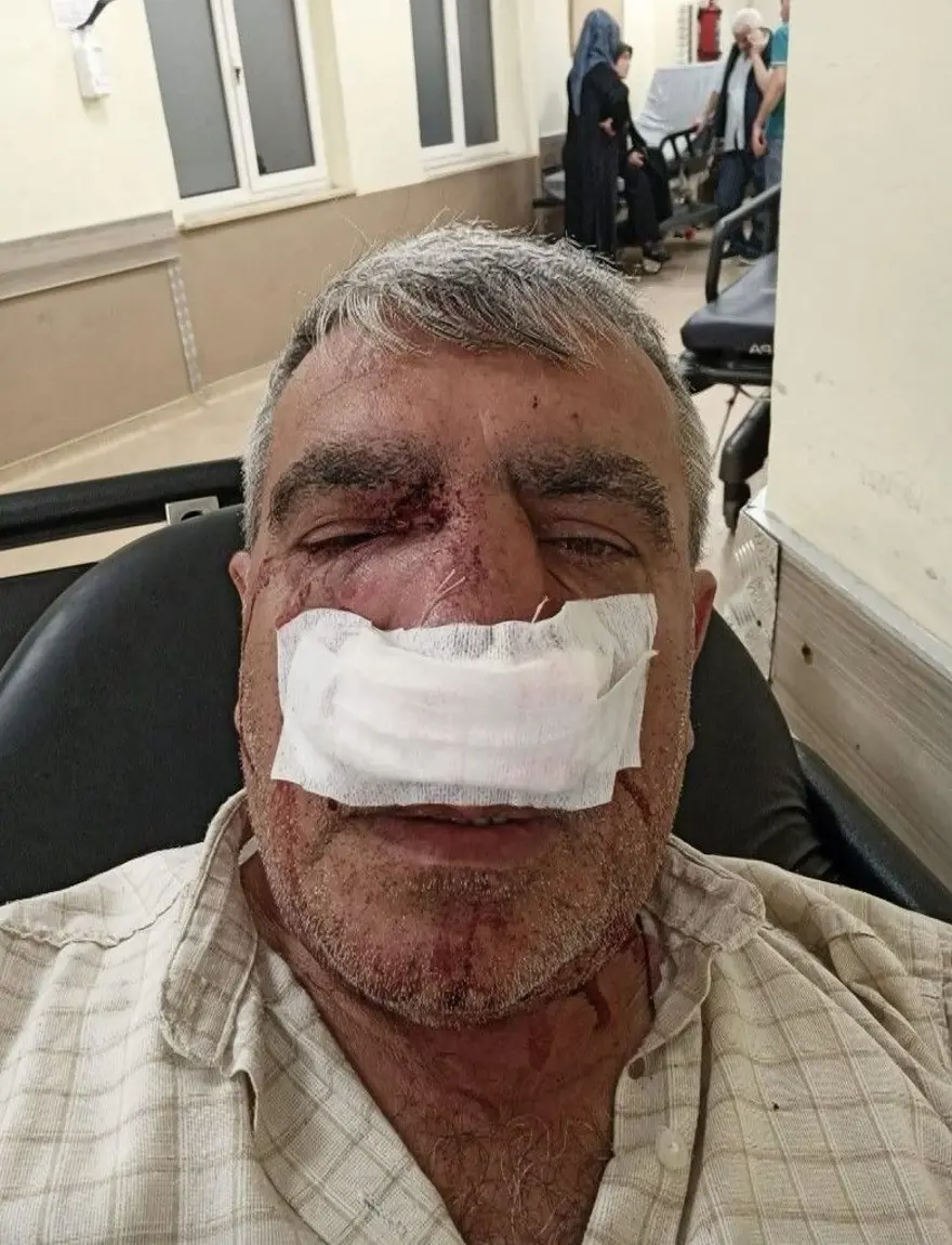 İstanbul’dataksiciden yayaya yumruk 5 İstanbul’dataksiciden yayaya yumruk 5