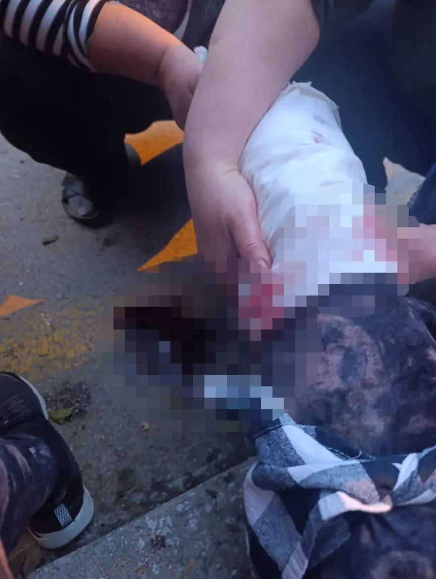 "KÖPEK TERÖRÜNDEN ADIM ATAMIYORUZ" 2 "KÖPEK TERÖRÜNDEN ADIM ATAMIYORUZ" 2