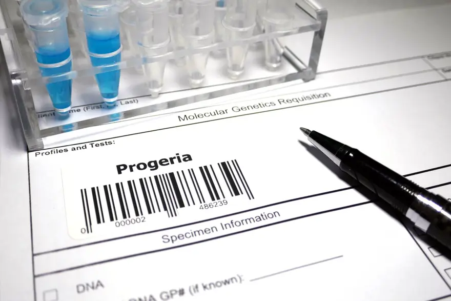 4 milyonda 1 görülüyor: Bu hastalığa yakalanan en fazla 20 yıl hayatta kalabiliyor 3 4 milyonda 1 görülüyor: Bu hastalığa yakalanan en fazla 20 yıl hayatta kalabiliyor 3