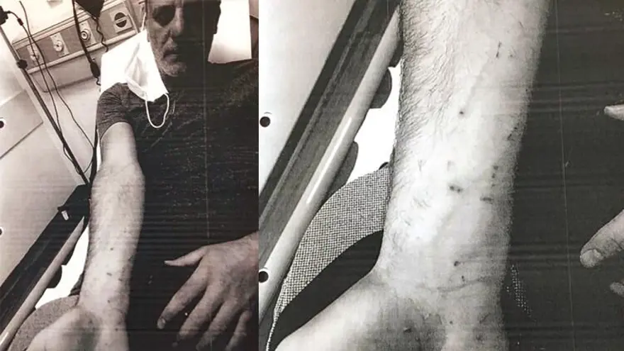 Ozan Güven ve Deniz Bulutsuz'un karşılıklı yargılandıkları dava: Ayağının altında cam kesikleri vardı 1 Ozan Güven ve Deniz Bulutsuz'un karşılıklı yargılandıkları dava: Ayağının altında cam kesikleri vardı 1