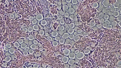 Laboratuvarda ilk canlı insan derisi geliştirildi