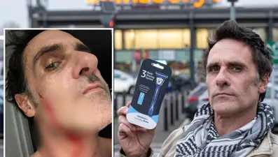 Tıraş bıçağıyla yüzünü kesti: 211 bin lira kazandı