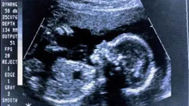 Ceninin kalp atışı, kan hücresi oluşturuyor