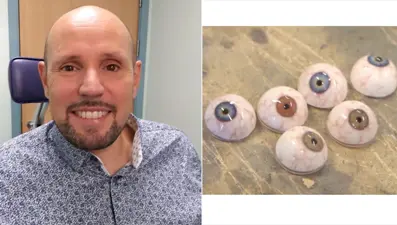 3 boyutlu yazıcıyla göz protezi