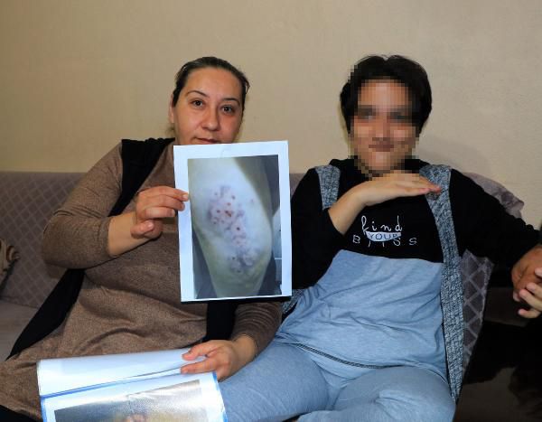 Adana'da otizmli kızın rehabilitasyon merkezinde darp edildiği iddiası