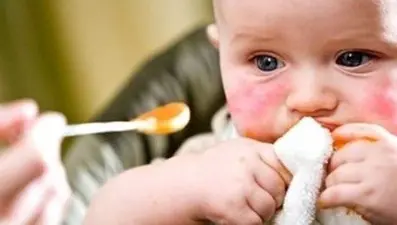 Sezaryen doğan çocuklarda gıda alerjisi görülme ihtimali daha yüksek