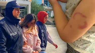 Kreşte akılalmaz olay: Çocuğu ısıran bakıcı için karar verildi