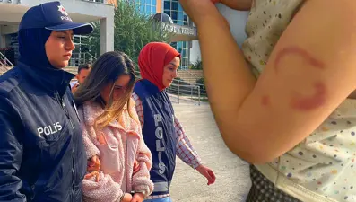 Kreşte akılalmaz olay: Çocuğu ısıran bakıcı için karar verildi