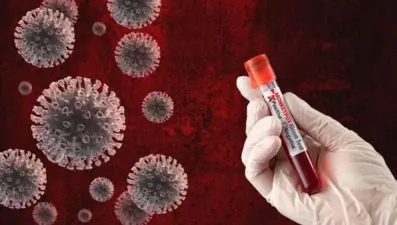 Kosova'da ilk maymun çiçeği vakası tespit edildi