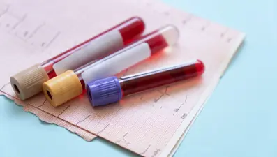 100 yaşını görmenin sırrı kan değerlerinde gizli