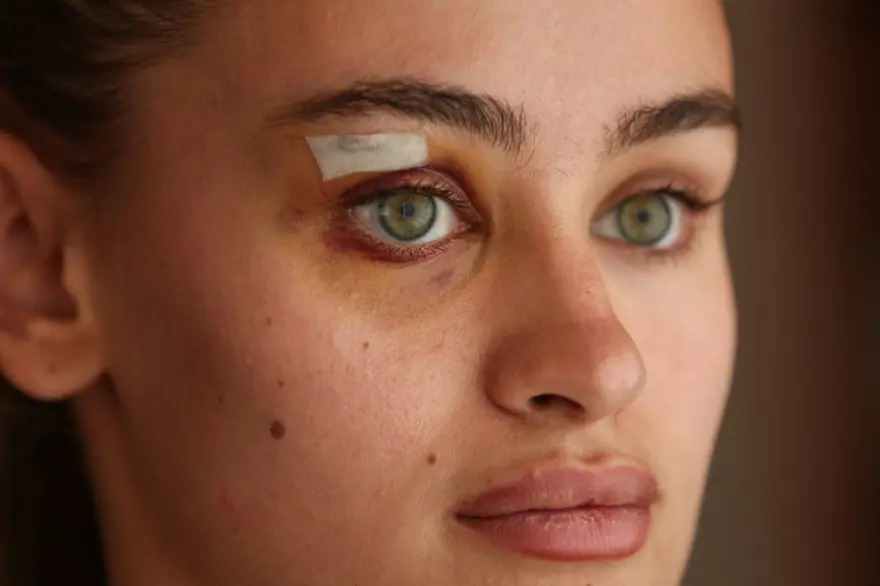 Ukraynalı model darp iddiasıyla ilgili konuştu 7 Ukraynalı model darp iddiasıyla ilgili konuştu 7