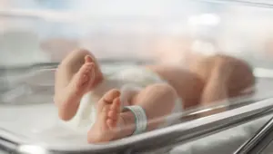 Yemek borusu olmadan doğuyorlar (Özofagus atrezisi ile mücadele için buluştular)