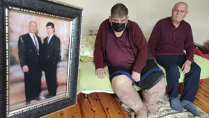 Sivrisinek ısırığı hayatını kararttı