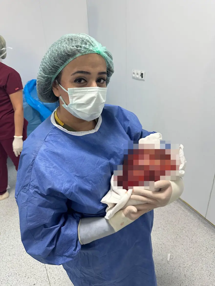 2 belirtiyle doktora gitti: Karın bölgesinden çıkan şaşırttı 4