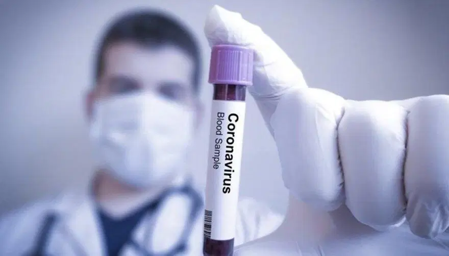 Covid-19 tahmin edilenden daha fazla kediye bulaşmış 53