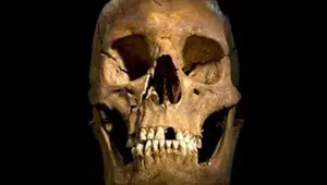 Kral Üçüncü Richard'ın kafatası bulundu