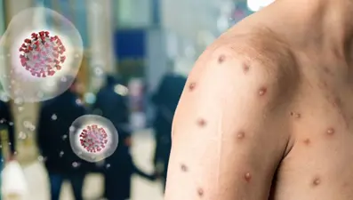 Acil durum ilan edilmişti! Salgın durdurulamıyor, dünya genelinde can kayıpları arttı