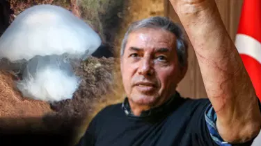 Uzmanlardan uyarı: Denizanası çarpmasında tatlı su dökmeyin