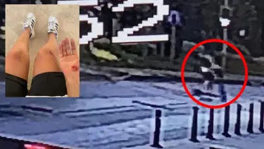 İşe giderken köpeklerin saldırısına uğradı