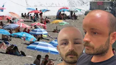 İki gün plaja gitti, başında ödem oluştu: Doktorlar bilimsel çalışma yapılmasına karar verdi